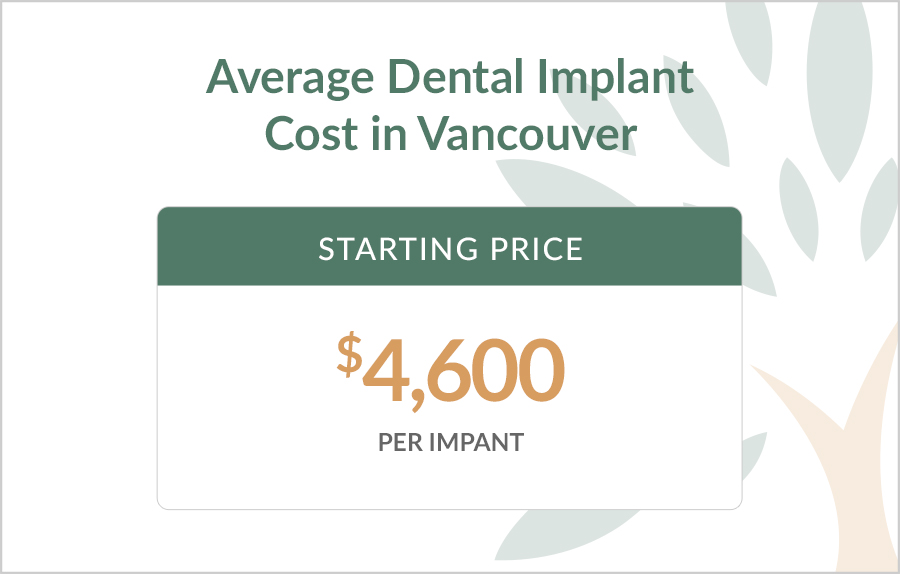 Average Dental Implant Cost in Vancouver