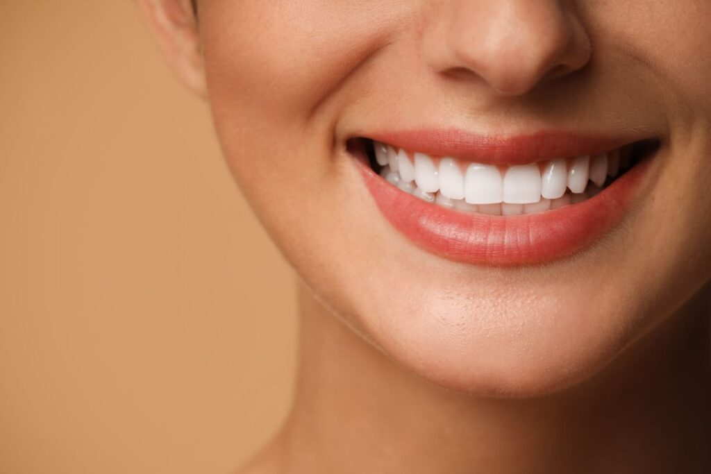dental veneers